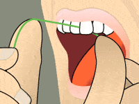 flossing_3