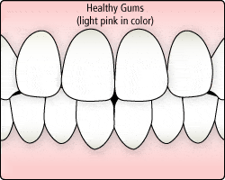 healthy-gums healthy-gums